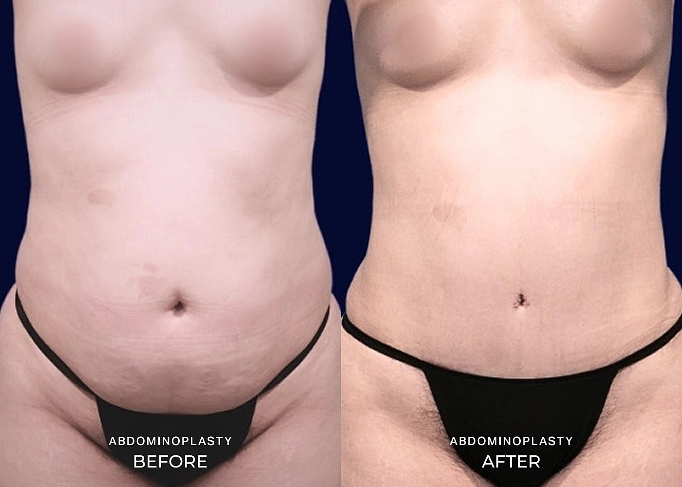 Before and after body image comparison.