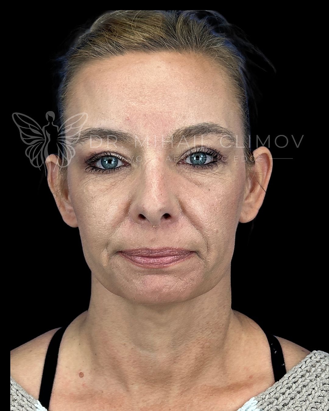 Woman with natural makeup against black background.