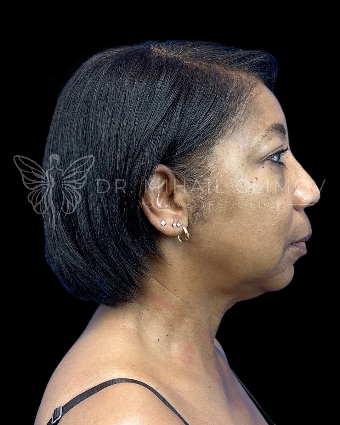 Profile view of woman with short hairstyle.