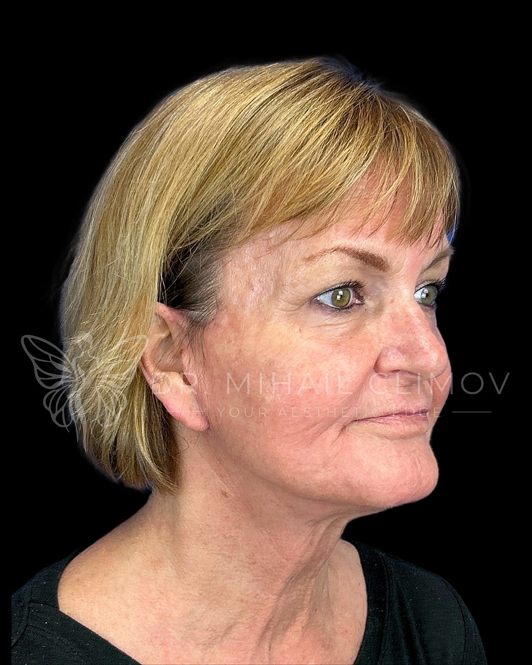 Profile view of a middle-aged woman.