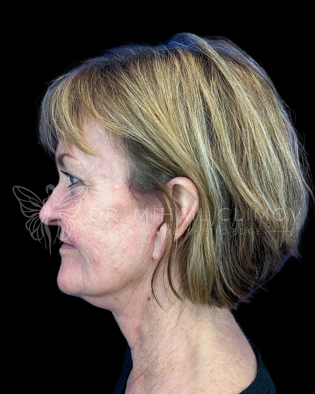 Profile shot of a woman with blonde hair.