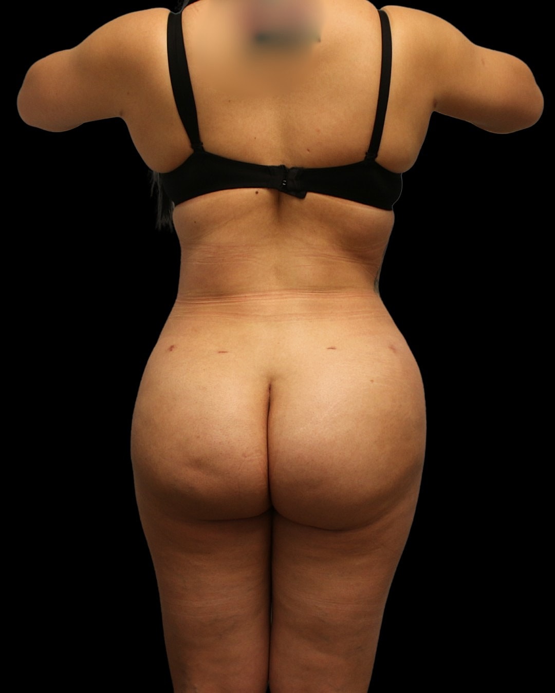 Celluleaf Before & After