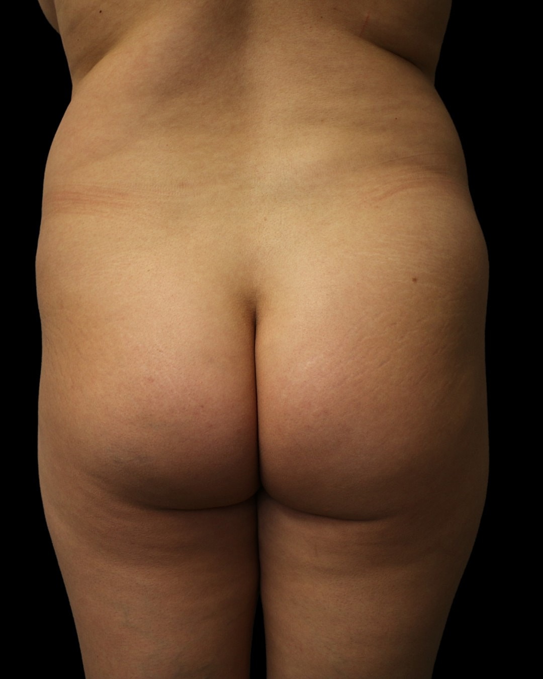 Celluleaf Before & After