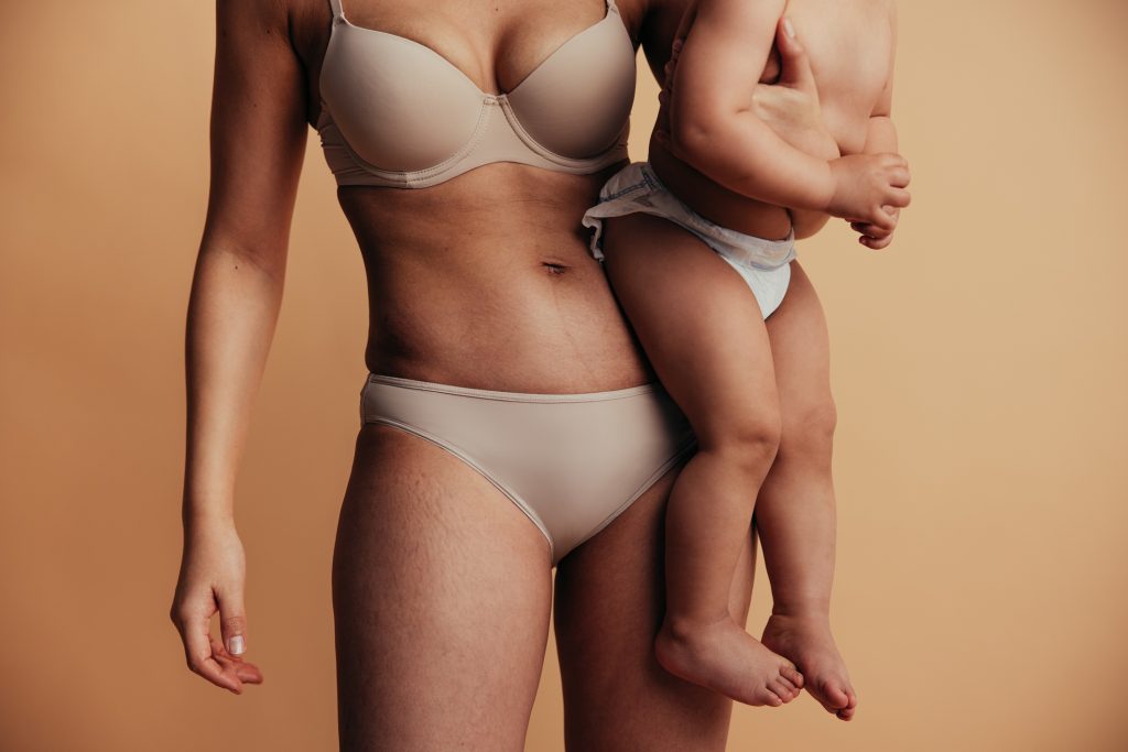 Postpartum mother smiling in a relaxed setting, representing confidence after a Mommy Makeover procedure